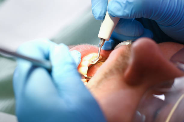 Best Emergency Treatment for Dental Infections or Abscesses in Murray, KY