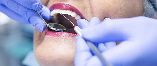 Best Emergency Treatment for Dental Infections or Abscesses in Murray, KY